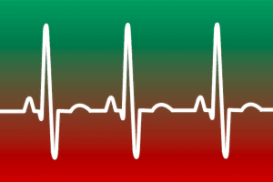 heartbeat - AutoCAD title block manager