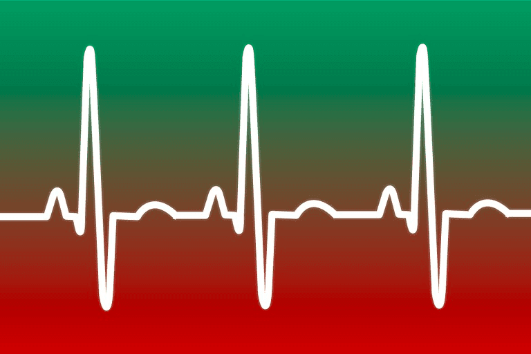 heartbeat - DGN to DWG conversion